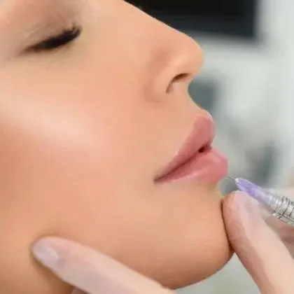 Aumento de labios con ácido hialurónico